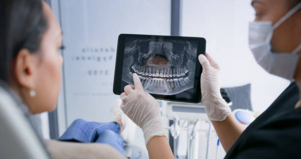Licensed Teeth Whitening service in Springfield, OH - Smile Center Dentistry